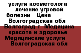 услуги косметолога, лечение угревой болезни › Цена ­ 1 000 - Волгоградская обл., Волгоград г. Медицина, красота и здоровье » Медицинские услуги   . Волгоградская обл.